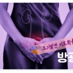 방광암 증상, 위험 요소, 진단과 검사 소개 3