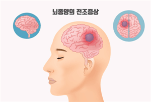뇌종양 증상, 검사와 진단, 치료(수술) 등 소개 7