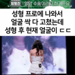 전혀 다른 사람 됨… 성형 후 인생 180도 바뀐 여자 11