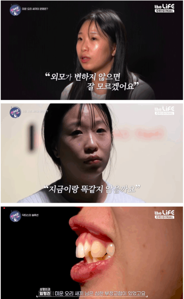 전혀 다른 사람 됨… 성형 후 인생 180도 바뀐 여자 3
