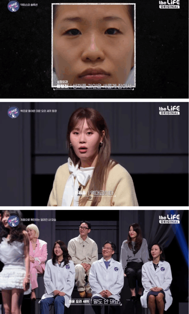 전혀 다른 사람 됨… 성형 후 인생 180도 바뀐 여자 5