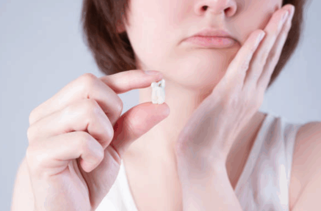 사랑니 발치비용 발치시기 치과 매복 발치 건강보험 적용 8