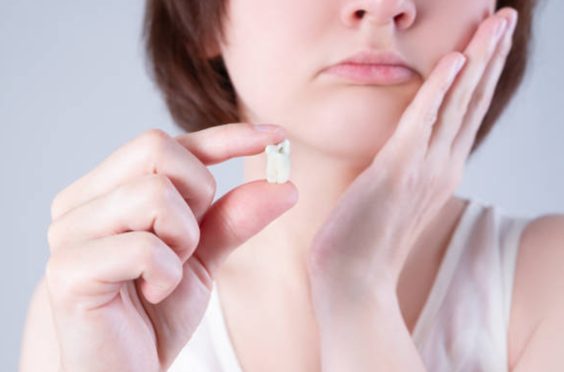 사랑니 발치비용 발치시기 치과 매복 발치 건강보험 적용 1