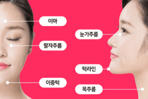 울쎄라 가격 병원별 가격차이 원인 피부미용 주름개선 탄력 시술 전 필수 체크사항 9